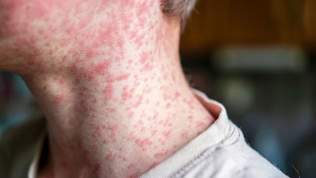 67d4528d59bf5b1656037eec